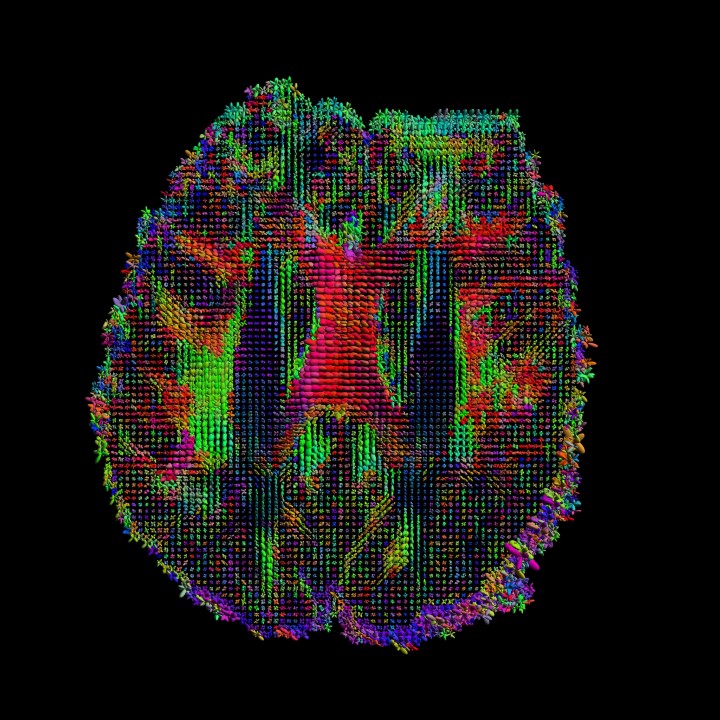 human connectome project